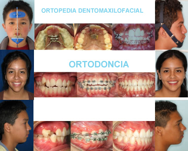 Ortodoncia y Ortopedia Dentomaxilofacial