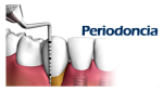 periodoncia